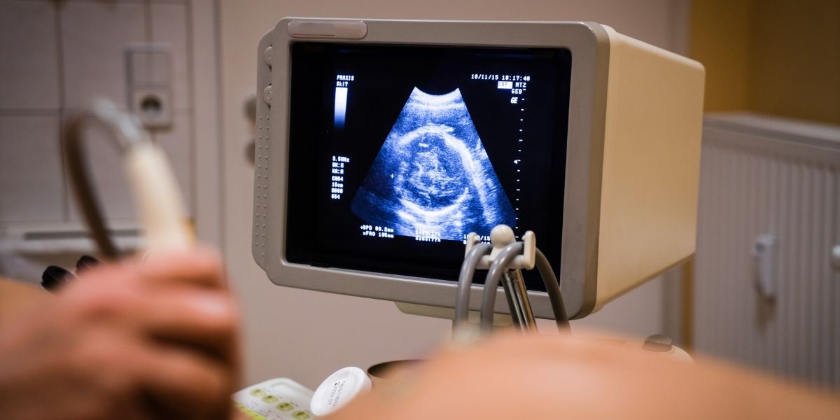 9-week-ultrasound